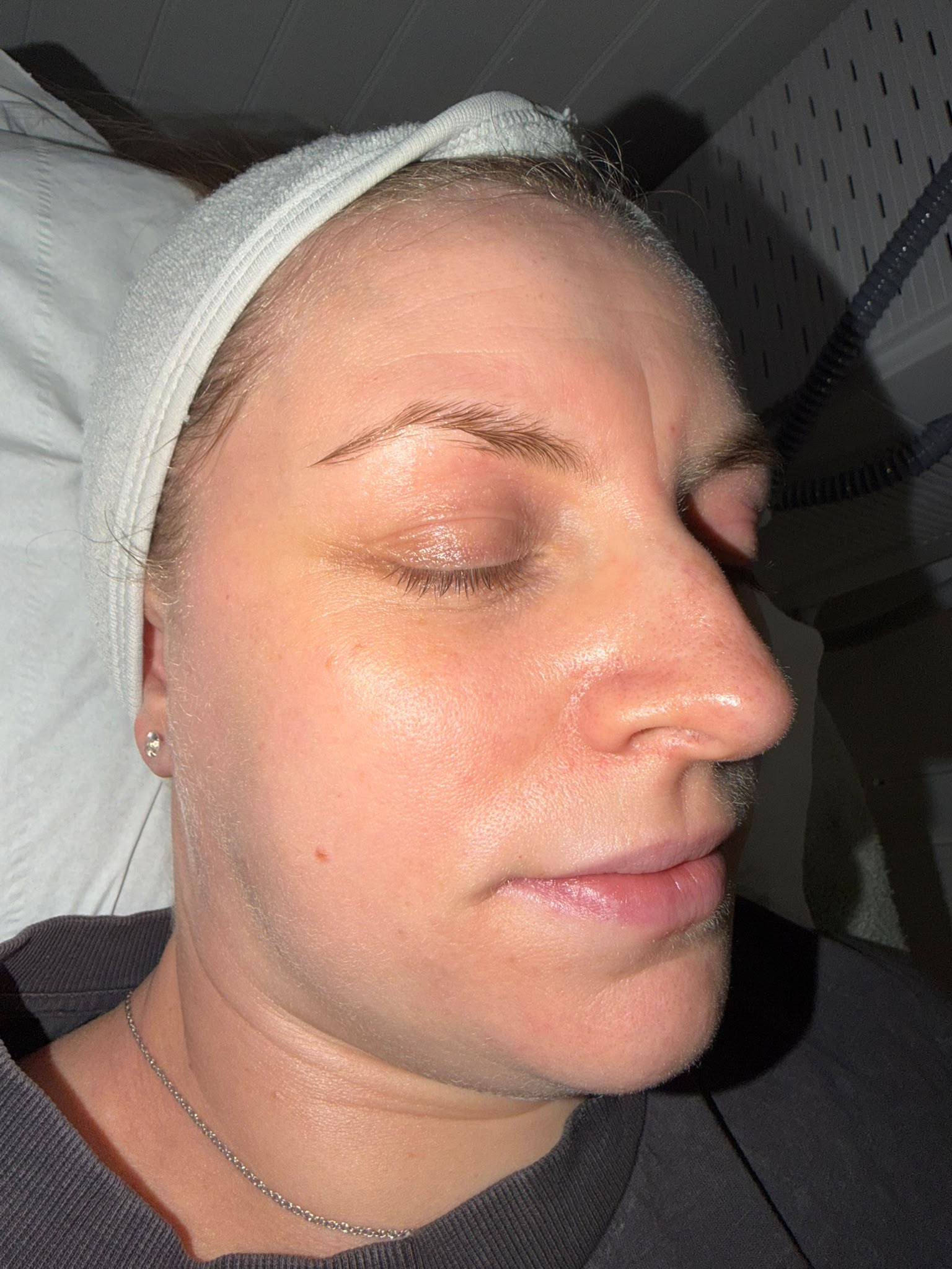 After treatment result 3