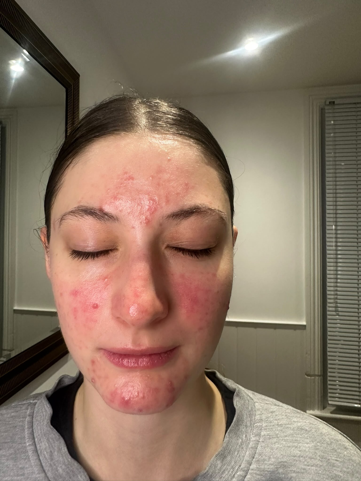 Before treatment result 2