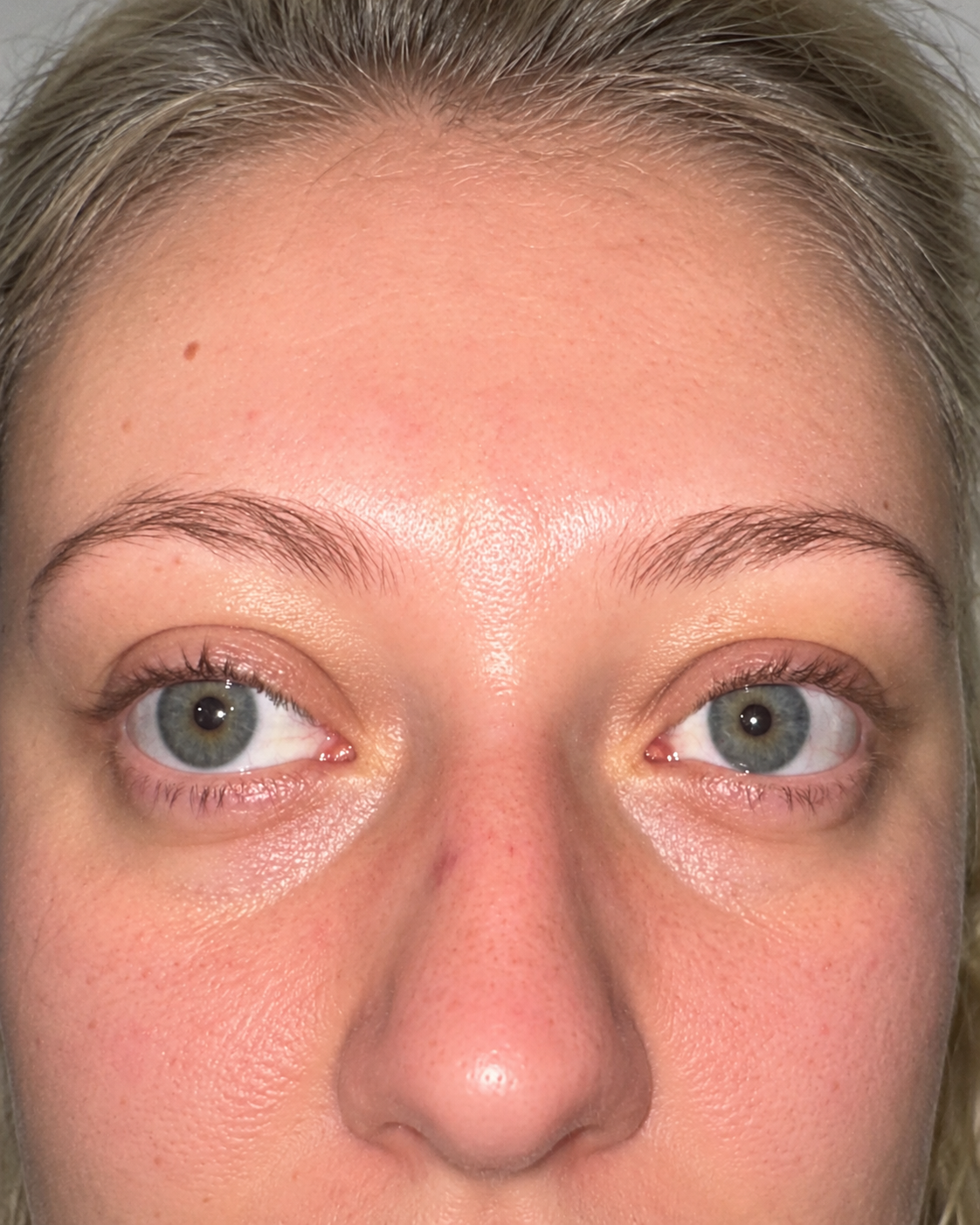 Client result 4 before