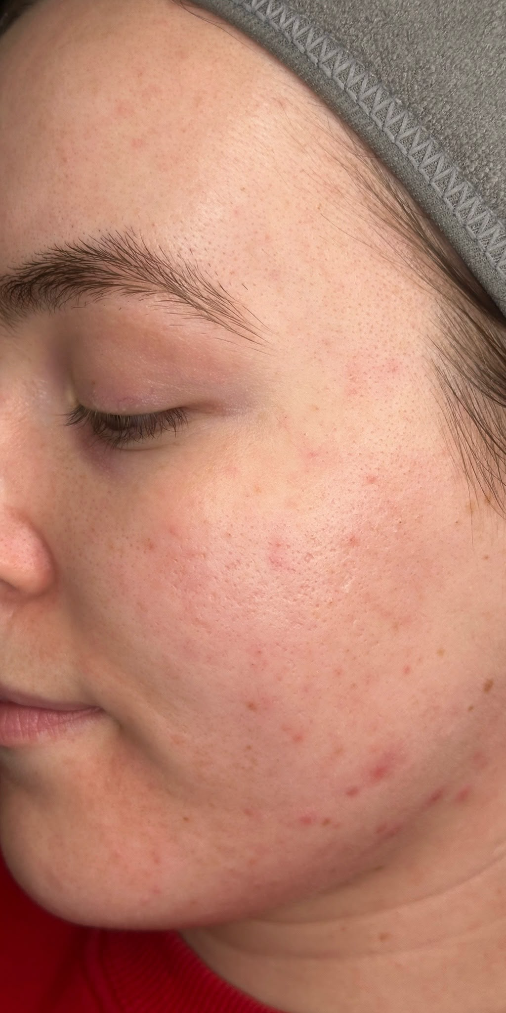 After treatment result 4
